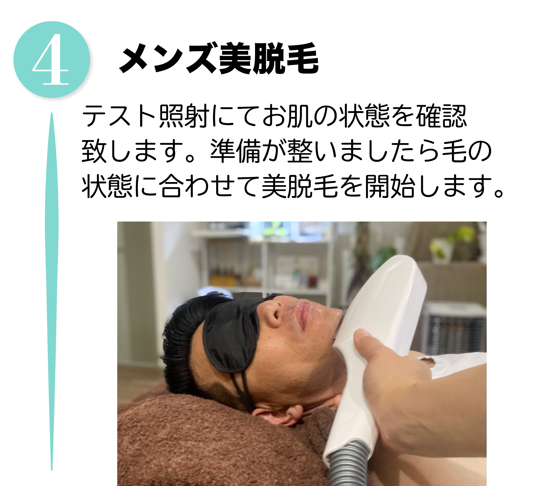 メンズ美脱毛